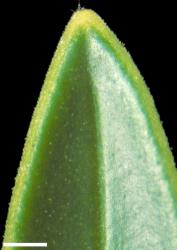 Veronica truncatula. Leaf apex and margins, showing short hairs. Scale = 1 mm.
 Image: W.M. Malcolm © Te Papa CC-BY-NC 3.0 NZ